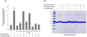 Those who commute to work or take road trips regularly, especially over long distances, may have come across toll plazas where you pay to cross over into another region. Nutrients Free Full Text Epimedium Koreanum Extract And Its Flavonoids Reduced Atherosclerotic Risk Via Suppressing Modification Of Human Hdl