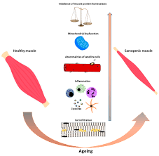 Check spelling or type a new query. Antioxidants Free Full Text Nutrition And Micrornas Novel Insights To Fight Sarcopenia Html