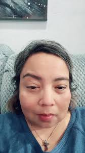 I Literally Broke My Tibia Last Week