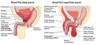The corpus spongiosum is of slightly higher reflectivity than the corpora cavernosa. Lecture 46 External Genitalia Ug Triangle Flashcards Quizlet