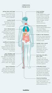 Image result for hepatitis symptoms