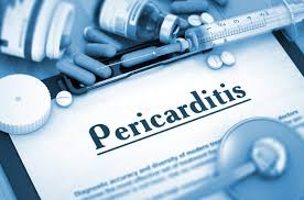 Myocarditis often occurs without symptoms and is sometimes recognized only after in symptomatic cases, the typical complaints of patients on a diverse, long lasting, not. Perimyokarditis Symptome Diagnose Verlauf Und Behandlung