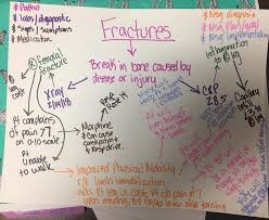 Fractures Concept Map Example Concept Map Nursing Nursing School Info Nursing School Notes