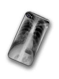 Tap the thumbnail to open it or swipe left. When I Get An Iphone X Ray Iphone Cases Radiology Humor
