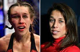 See more ideas about joanna jędrzejczyk, joanna, mma women. Joanna Jedrzejczyk Left With Sickening Hematoma After Ufc War With Zhang Weili Metro News