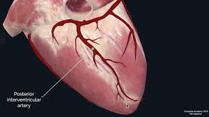 Hypoplastic left coronary artery was found in six specimens. Coronary Artery Anatomy Blood Supply To The Heart Geeky Medics