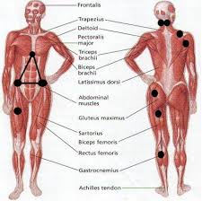 Fibromyalgia Trigger Points Effectively Treated With A