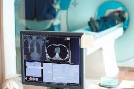 Risonanza Magnetica Encefalo A Cosa Serve Minihospital S Pertini