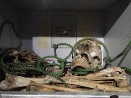 File:Remains of Victim Murdered by Dergue Regime - Red Terror Martyrs' Memorial Museum - Addis Ababa - Ethiopia (8666612732).jpg - Wikimedia Commons