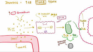 jaundice hepatic and biliary disorders msd manual