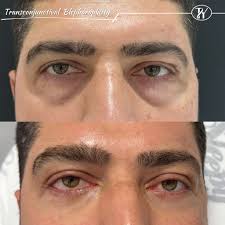 Image result for Blepharis transvaalensis