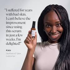 Amazon.com: 47 Skin Hydrating Face Serum for Clearing Acne & Scars,  Anti-Blemish & Scar Repair Serum Skincare Treatment with Silver Chitoderm