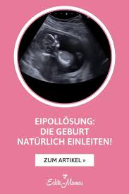 Inhaltsverzeichnis verbergen 1 was ist eine eipollösung? Eipollosung Die Geburt Naturlich Einleiten Echte Mamas Video Video In 2021 Geburt Zur Geburt Geburtstermin