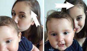 سبب تساقط الشعر بعد الولادة و متي يتوقف لـ الام المرضع بشرة وشعر postpartum hair loss hair loss causes hair loss