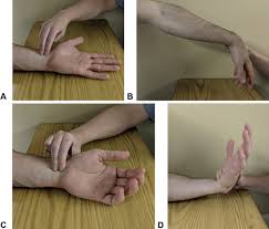 Image result for Carpal Compression Test