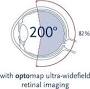 Digital retinal imaging from www.optomap.com
