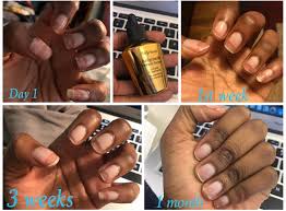 Nail repair pen nail growth enhancer anti fungal nail toe care serum treatment. Sally Hansen Nailgrowth Miracle Serum 0 37 Fluid Ounce Walmart Com Walmart Com