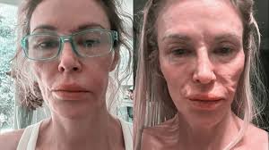 RHOBH’s Brandi Glanville Says She’s Spent $70K