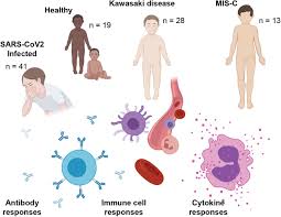 Image result for Multisystem Inflammatory Syndrome