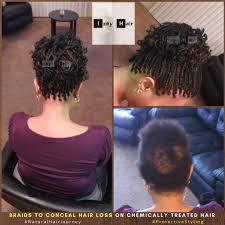 My favourite hairstyles for alopecia! Sudden Hair Loss And Alopecia One Braid Protective Styling Option