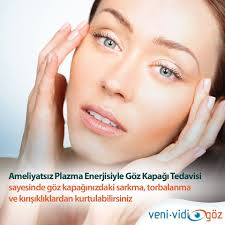 Ameliyatsiz Plazma Enerjisiyle Goz Kapagi Tedavisi Gozler