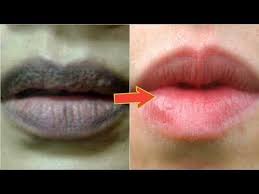 Tidak Perlu Pakai Lipstik Lagi Cukup Oles Ini Bibir Menjadi Merah Merona Youtube Trik Makeup Bibir Perawatan Kulit