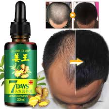 Fast hair growth serum oil treatment for hair loss natural essence for men women. Amazon Com Hair Regrow 7 Day Ginger Germinal Essential Oil Hair Growth Hair Loss Treatment Hair Care Hair Growth Serum For Men Women 30ml Beauty