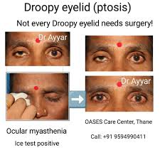 Image result for Ice Pack Test