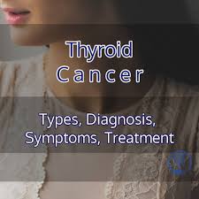 Some thyroid cancers are mixtures of papillary and follicular cells. Thyroid Cancer Types Symptoms Diagnosis Treatment Pmcc Denver Oncology Denver Concierge Medicine
