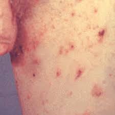 Pin On Health