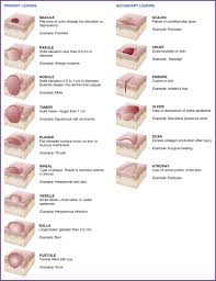 Assisting In Dermatology Nurse Key