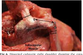 Anterior graphic of the shoulder. Pdf Quantitative Assessment Of The Coracoacromial And The Coracoclavicular Ligaments With 3 Dimensional Mapping Of The Coracoid Process Anatomy A Cadaveric Study Of Surgically Relevant Structures Semantic Scholar