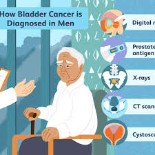Males are more often affected than females. Bladder Cancer In Men Symptoms And Diagnosis