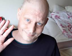 Don't make my mistake' warns singer diagnosed with testicular cancer