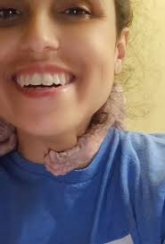 Is it rare for a Sphynx cat to attack its owner while sleeping?