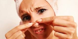 Cara pertama yang bisa kamu lakukan untuk menghilangkan jerawat dengan jeruk nipis adalah dengan mengaplikasikan air dari buah yang sudah diperas. Cara Alami Menghilangkan Dan Mengatasi Jerawat Batu Di Hidung Dengan Cepat Dan Efektif