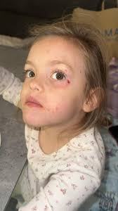 What is wrong with people who deliberately destroy a tree?? This is more  mindless vandalism in Inchyra Park. I am extremely unhappy that all the  good work we are doing in the