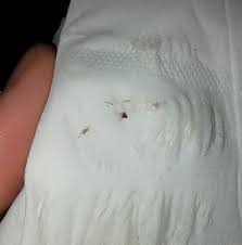 Hormonal or 'breakthrough' bleeding can happen at about 4 to 8 weeks into pregnancy (so round bleeding, or brown, watery discharge, in the first 12 weeks that's accompanied by strong, painful. Graphic Tiny Tiny Implantation Bleeding Page 1 Babycenter