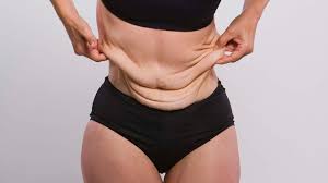 In general, a young person who loses less than 30% of their weight won't have a problem with loose skin. How To Get Rid Of Loose Skin After Weight Loss