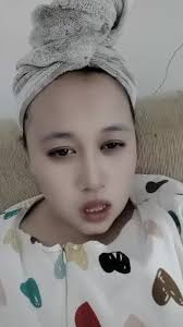 Pengalaman Mengenai Tanda Merah pada Bayi