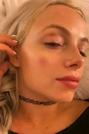 Did they ever explain how Fane survived the fall?