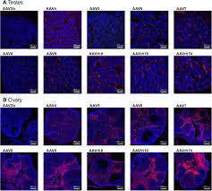 Image result for Blue 1998 AAV