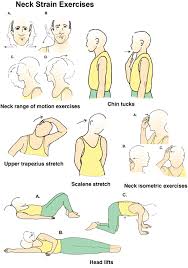 Cervical Sprain Active Care Physiotherapy Clinic Neck Exercises Neck Strain Exercises Physical Therapy Exercises