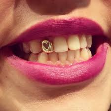 Image Result For Gold Tooth Cap Gold Tooth Cap Gold Teeth Teeth Caps