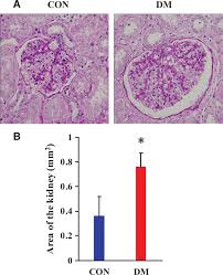 Kidney cooking | georgia council on renal nutrition. Role Of Toll Like Receptors In Diabetic Renal Lesions In A Miniature Pig Model Science Advances