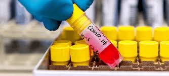 Price of $90.00 per common share, for total gross proceeds of approximately $450 million. Curevac Shares Surge Following Ipo Sharecast Com