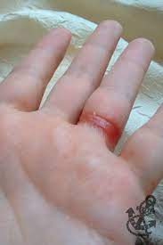 Harsh Preservatives Found In Many Cosmetics And Household Products Coffee Vanilla Skin Allergies Allergy Eyes Beauty Nails