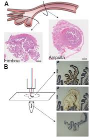 (bacteriology) hairlike appendage found on the cell surface of many bacteria. Pdf Integrative Transcriptome Analyses Of The Human Fallopian Tube Fimbria And Ampulla Site Of Origin Of Serous Carcinoma Of The Ovary Semantic Scholar