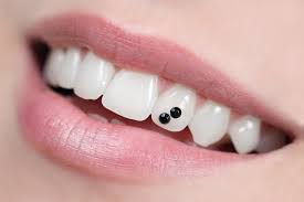 I wanted to get lumineers shaped like vampires. Unusual Cosmetic Dentistry Trends Presented By Deerfield Dentist Arlington Heights Il