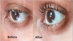 Do you feel that your hair has stopped growing for a while now? Apply Coconut Oil To Grow Long Eyelashes Fast Thick Eyelashes Fast Eyelashes Hair Growth Youtube
